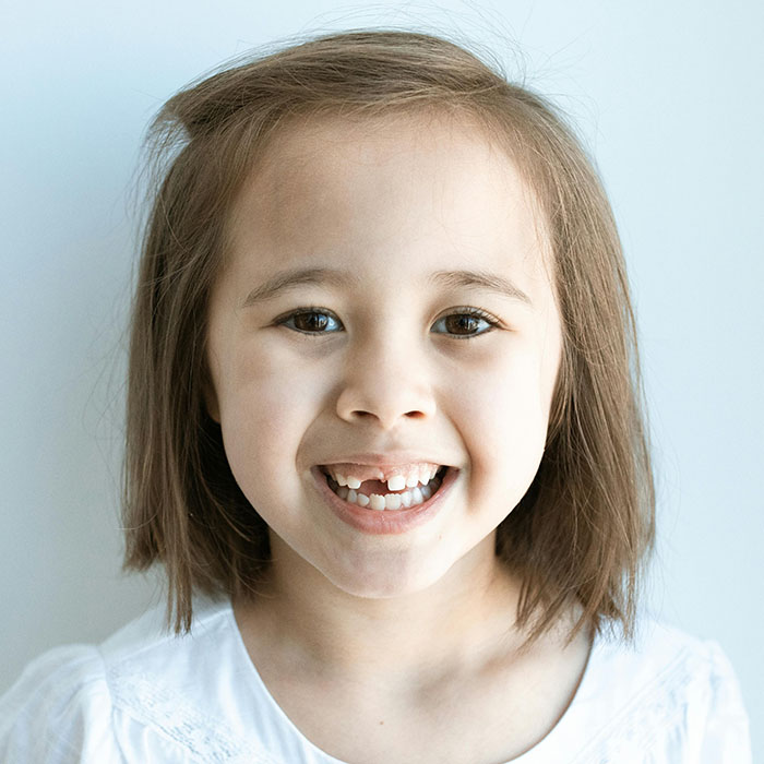 What Do Different Cultures Do With Baby Teeth?